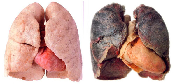 pulmones-sanos-y-de-fumador
